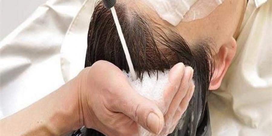 علاقة نوع فروة الرأس بتساقط الشعر .. واعرف أهم الأسباب - لايف نيوز