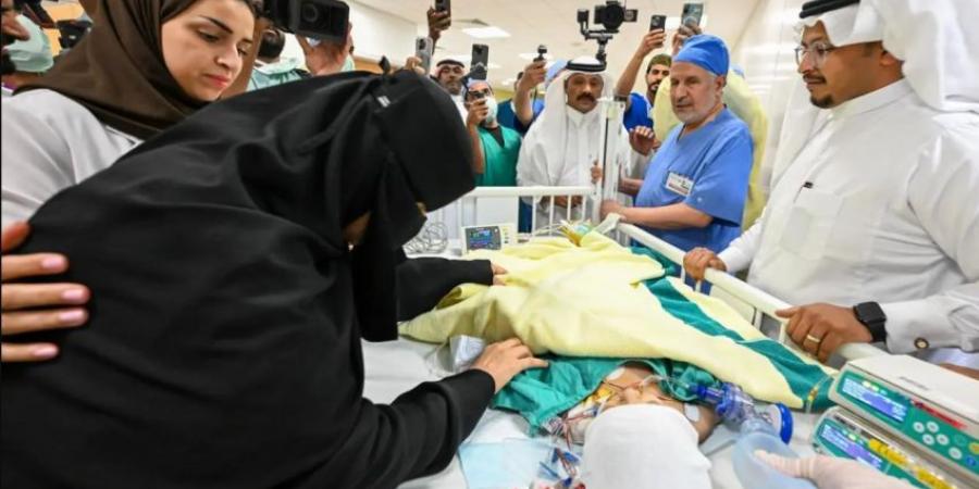 نجاح عملية فصل التوأم الملتصق السعودي يارا ولارا بعد عملية جراحية دقيقة استغرقت (12) ساعة ونصفًا - لايف نيوز